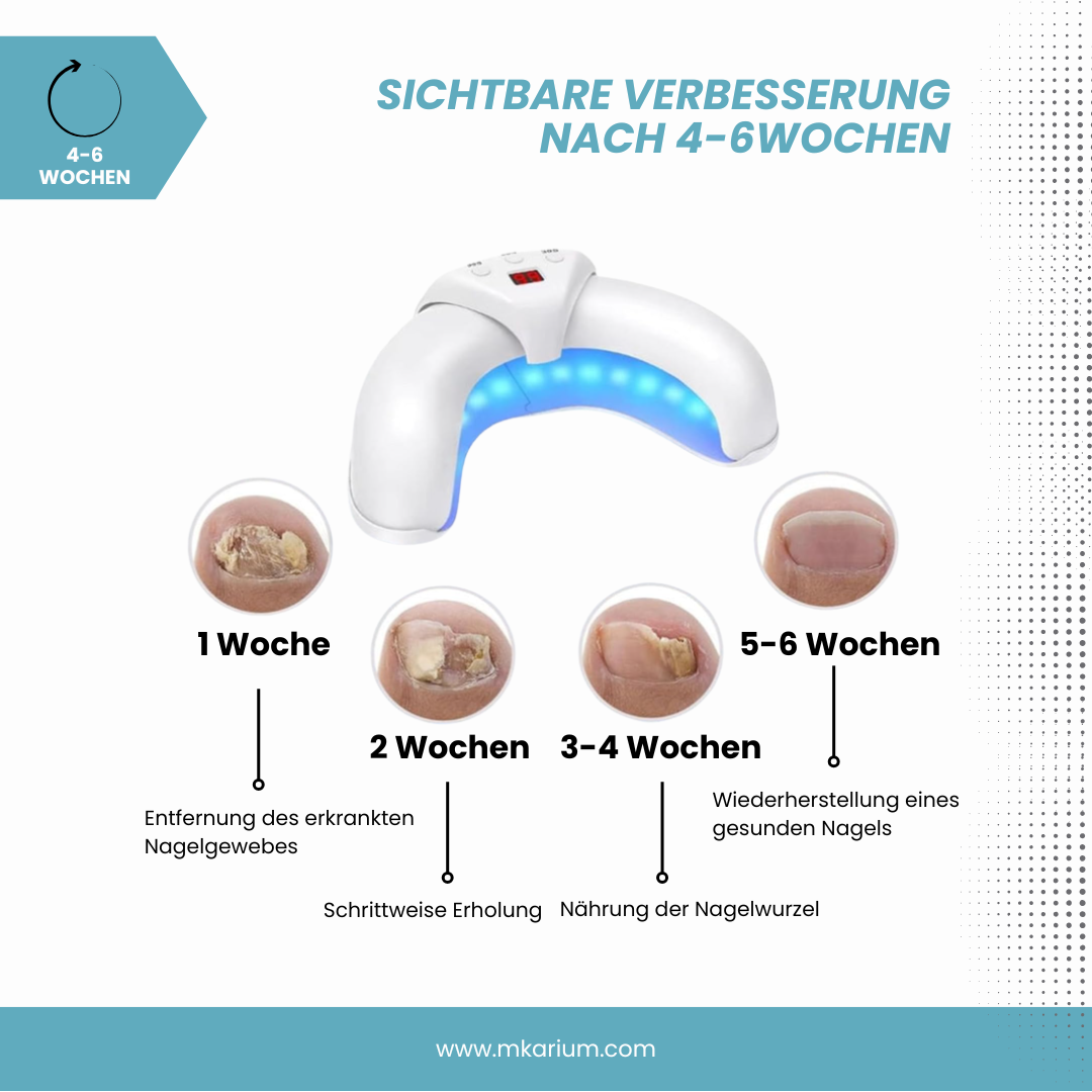 LumiNail™ - Deine tägliche Lichttherapie für gesunde Nägel