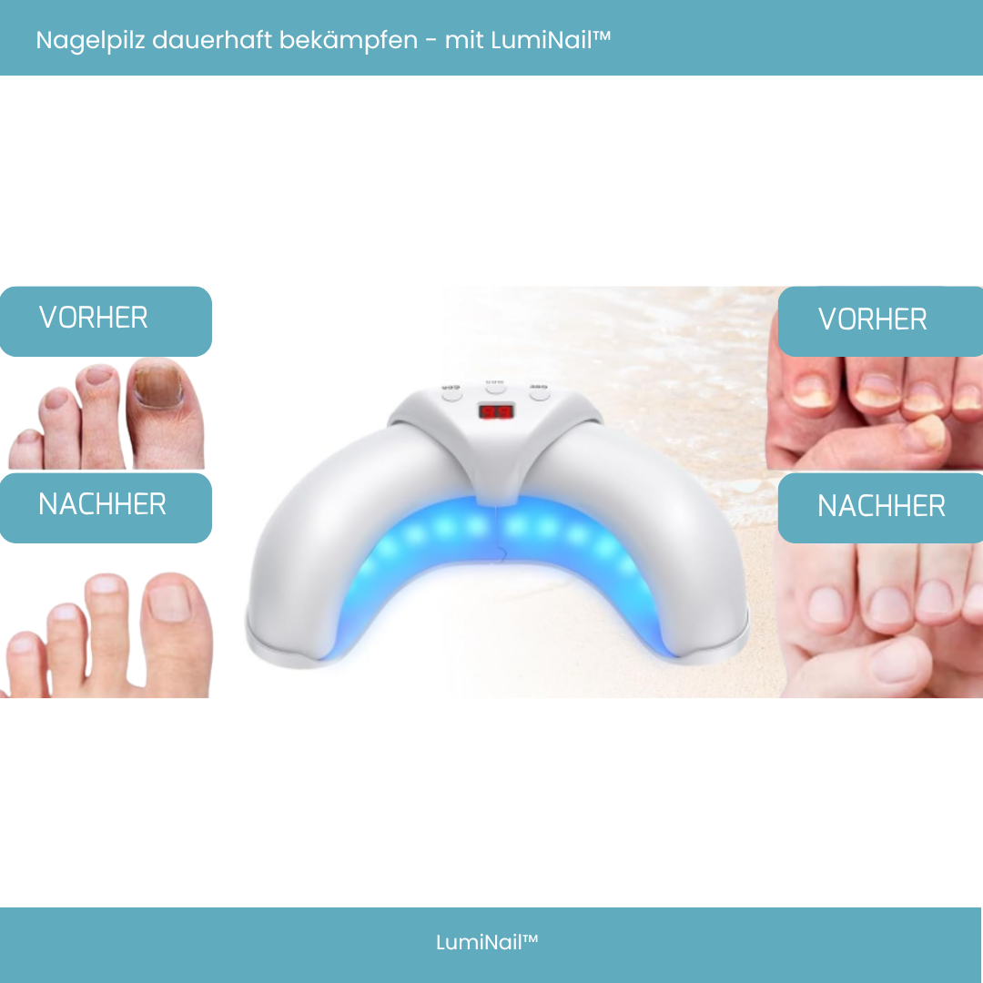 LumiNail™ - Deine tägliche Lichttherapie für gesunde Nägel
