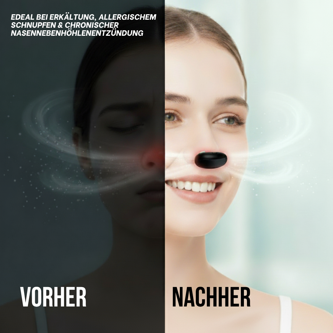 Rhinolux™ - Die Revolution gegen Schnupfen