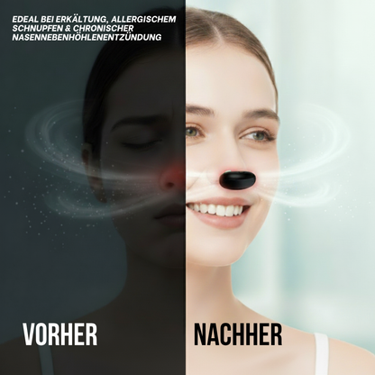 Rhinolux™ - Die Revolution gegen Schnupfen
